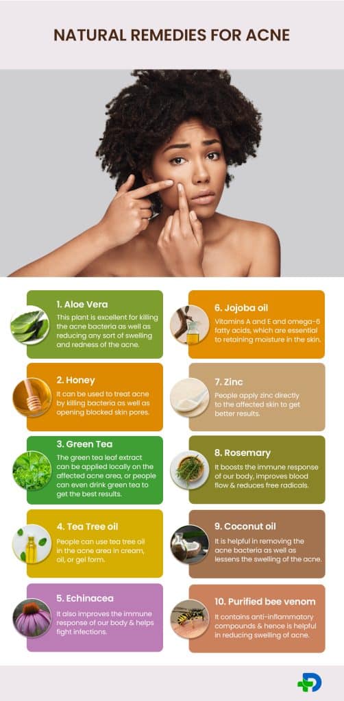 Natural remedies to treat acne