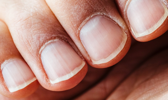 Fungal nail infections : A General Overview