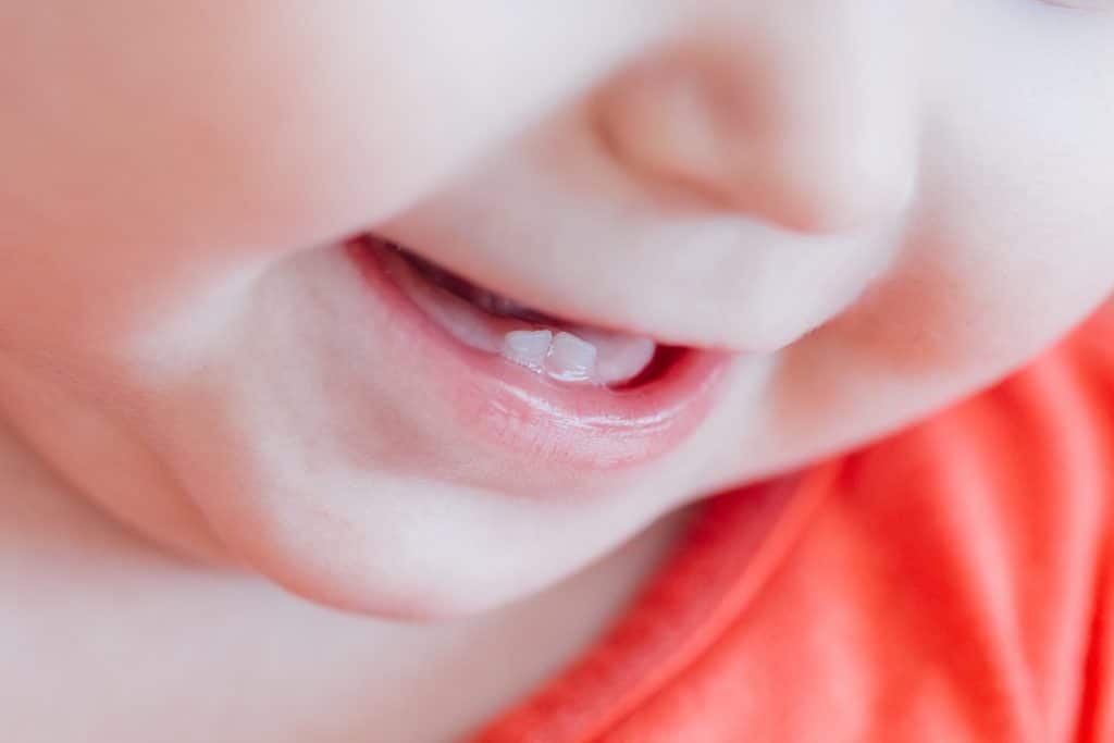 The first set of teeth to erupt in a child’s mouth is known as baby teeth, often called primary or deciduous teeth. 