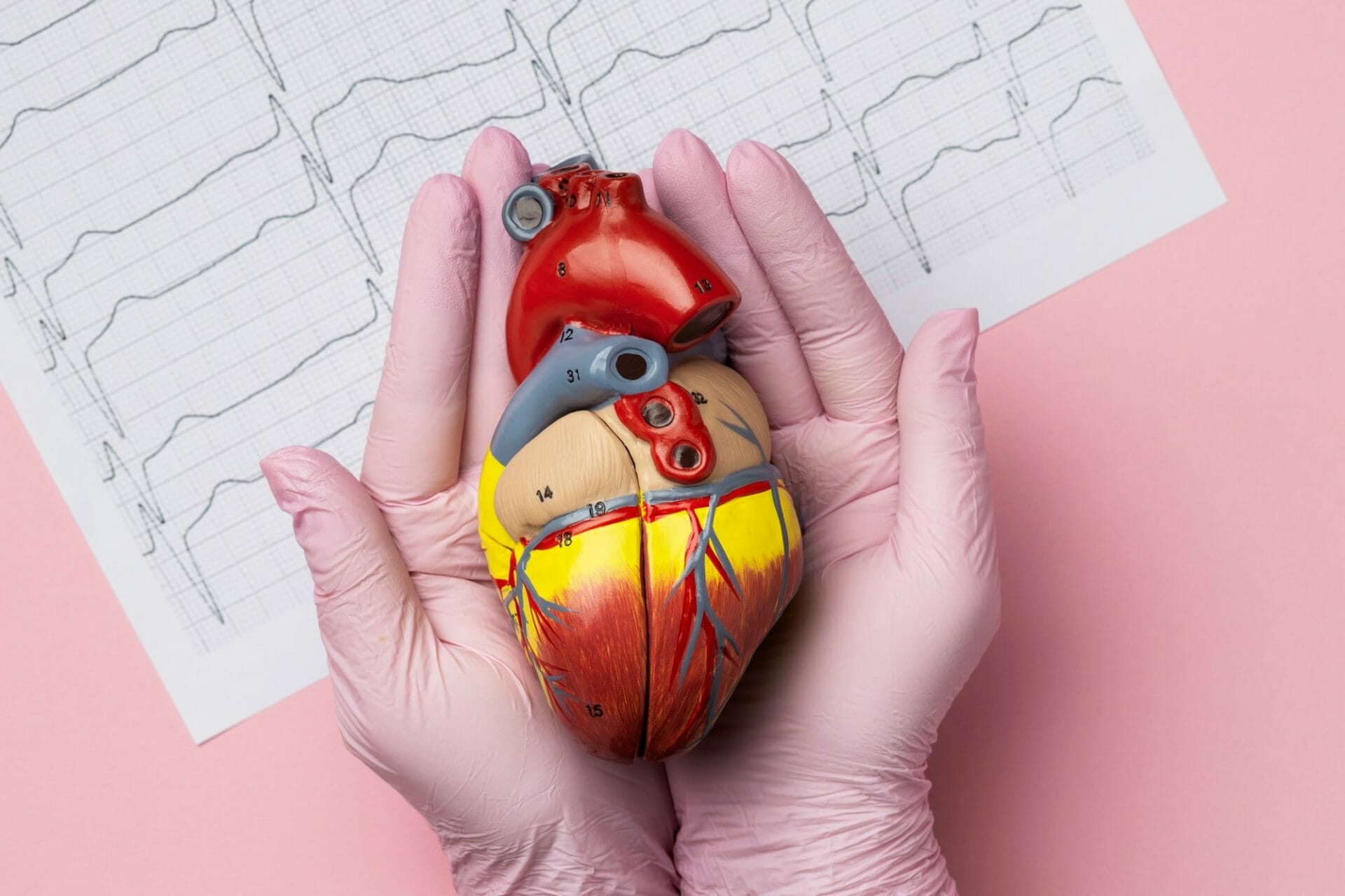 Atrial Fibrillation : A General Overview
