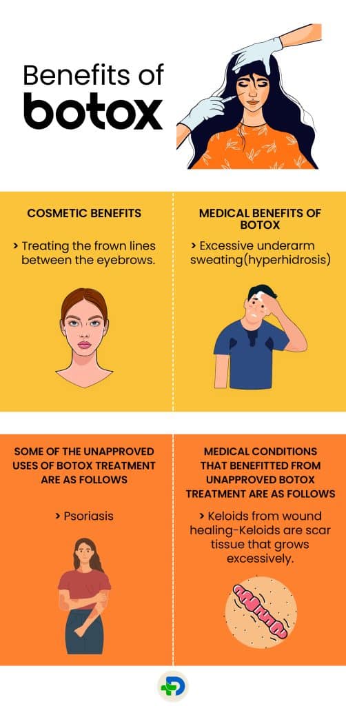 Benefits of Botox.