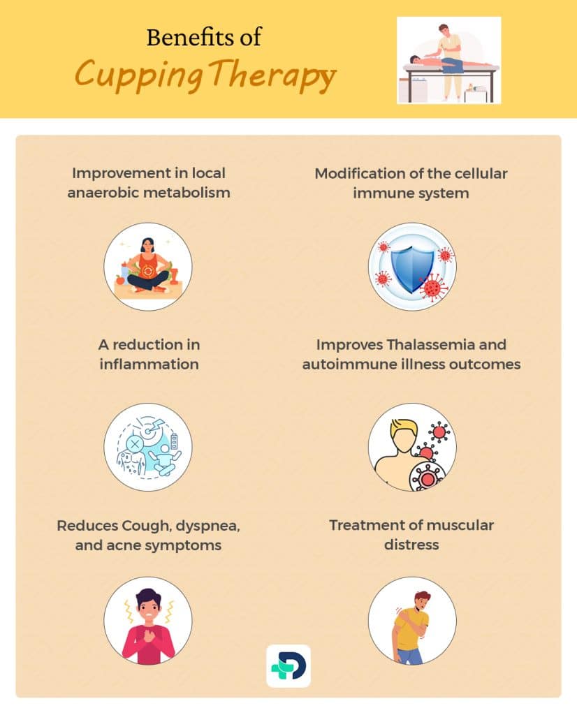 Benefits of Cupping Therapy.