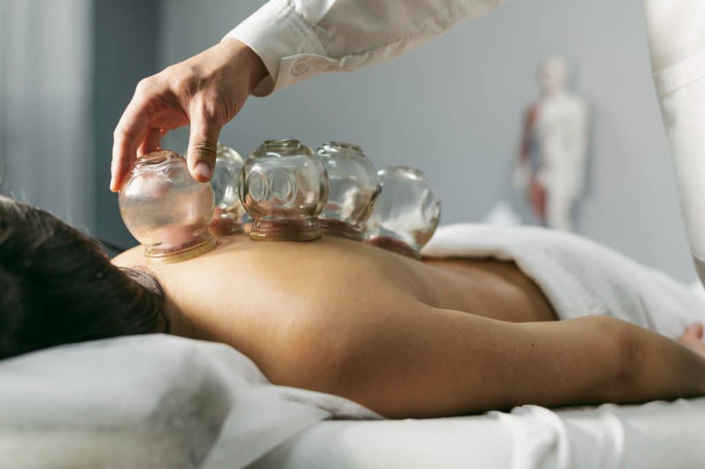 The practice of cupping therapy is typically defined as a method that makes use of cups that are positioned over the patient's skin in order to generate a state of negative pressure through the use of suction. 