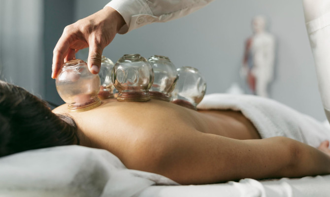 What is Cupping Therapy ? Types, Uses, and Benefits