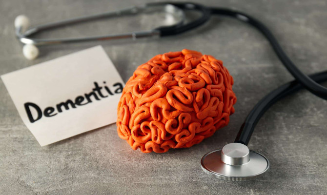 Dementia : Types, Stages, and Treatment