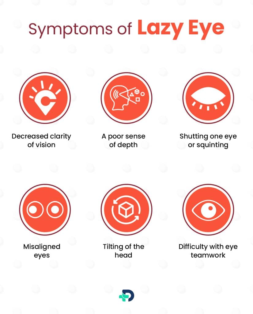 Symptoms of Lazy Eye.
