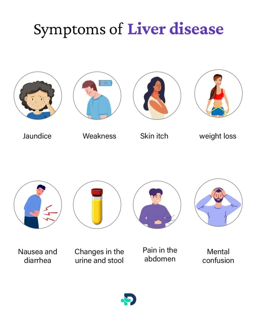 Symptoms of Liver Disease.