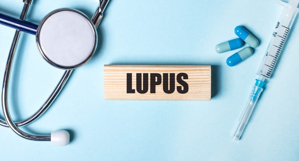 Lupus is a persistent autoimmune condition that can impact numerous bodily systems. Lupus arises when the immune system, which typically defends the body against infections and illnesses, mistakenly attacks its own tissues.