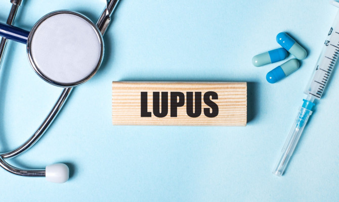 Lupus: What do you need to know?