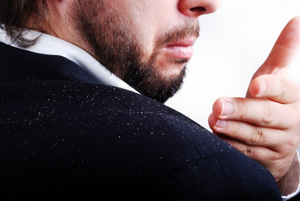 Dandruff is a skin disease that causes itchy and flaky skin. The visible white flakes of dead skin are usually seen between the hairs and on the shoulders.