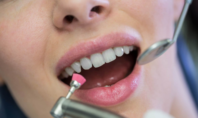 Dental Abrasion: Symptoms, Causes, and Treatment