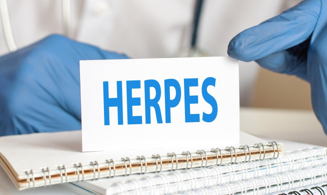 Herpes: Causes, Symptoms, and Management
