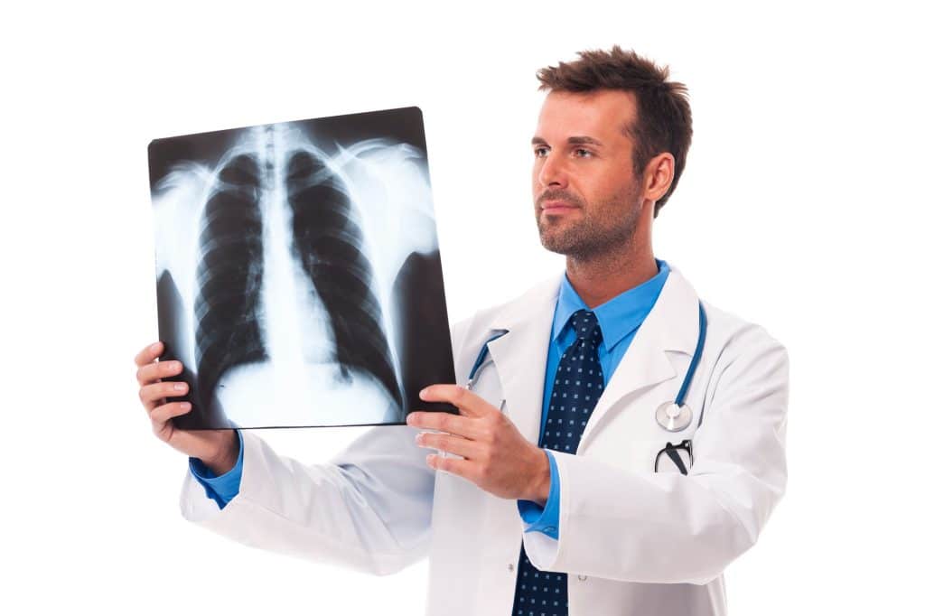 Lung cancer is a critical health concern affecting millions of people worldwide. It is a particular type of cancer that usually results from smoking and starts in the lungs. 