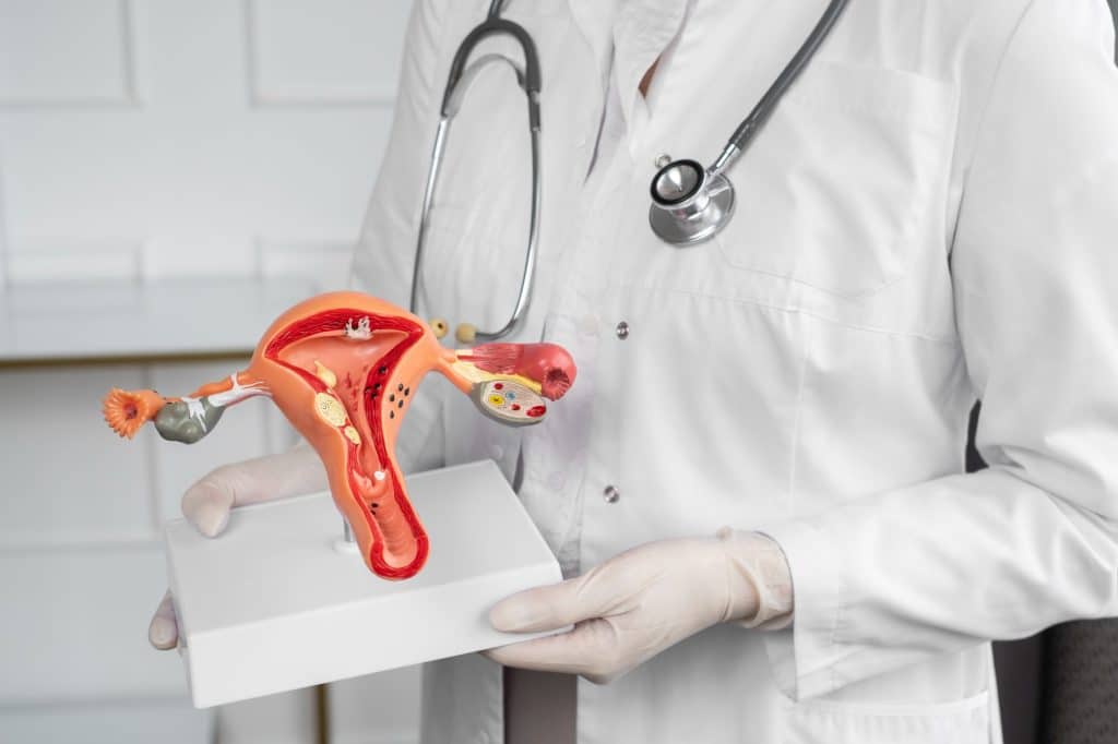 Endometriosis is a disorder in which tissue that is comparable to the lining of the uterus grows in various areas in the body except for the uterus itself. These areas of tissue are referred to as "implants," "lesions" or "nodules." 