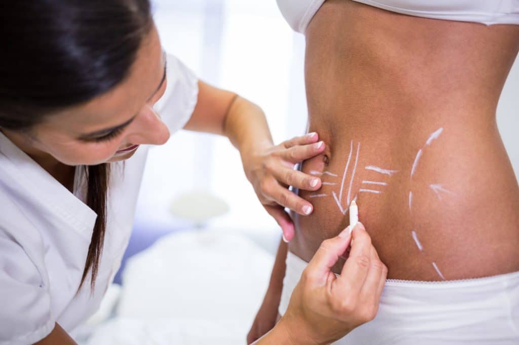 
Liposuction is a popular choice in the field of cosmetic surgery. It is a plastic surgery technique which involves the removal of fat (adipose tissue) from the body.