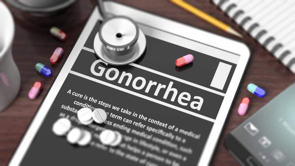 The STI known as gonorrhea is caused by the bacteria Neisseria gonorrhea. Although it can infect the rectum, mouth, and eyes, it usually impacts the genital regions.