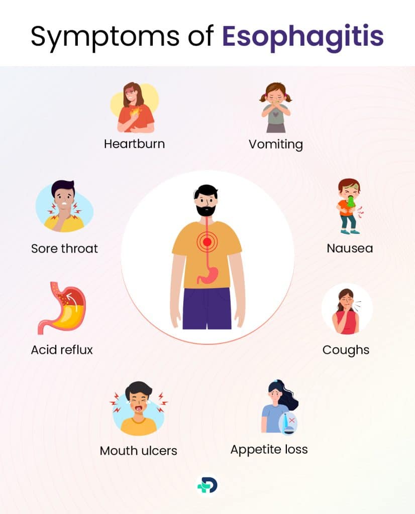 Symptoms of Esophagitis.