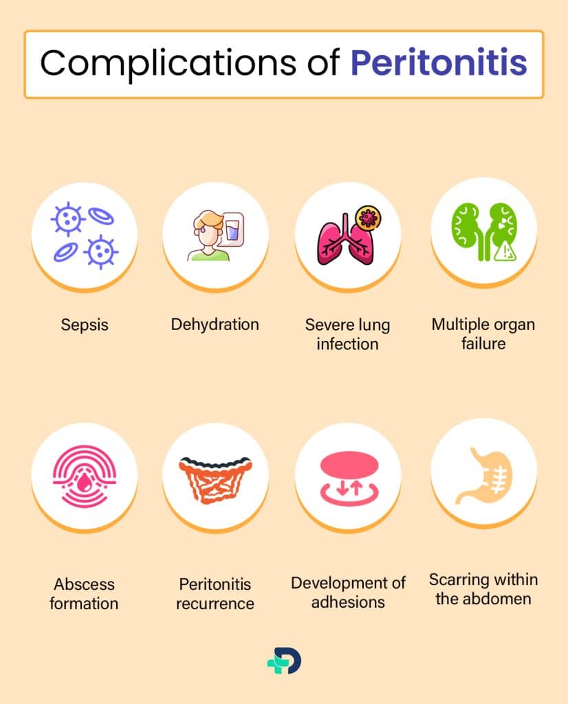 Complications of Peritonitis.