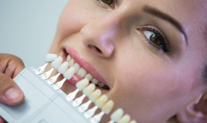 A Complete Guide to Transforming your Smile with Dental Veneers