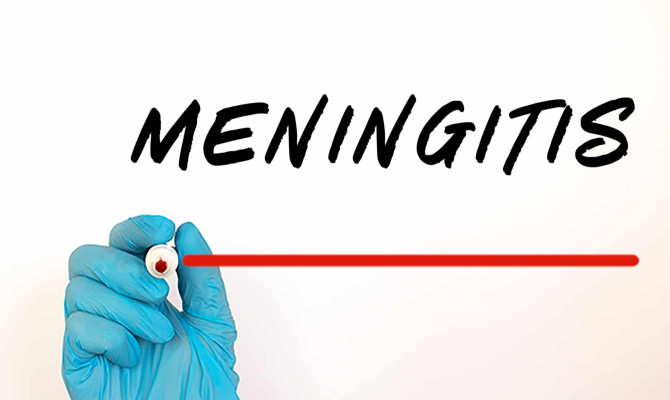 What is Meningitis: Symptoms, Types, Transmission and Treatment