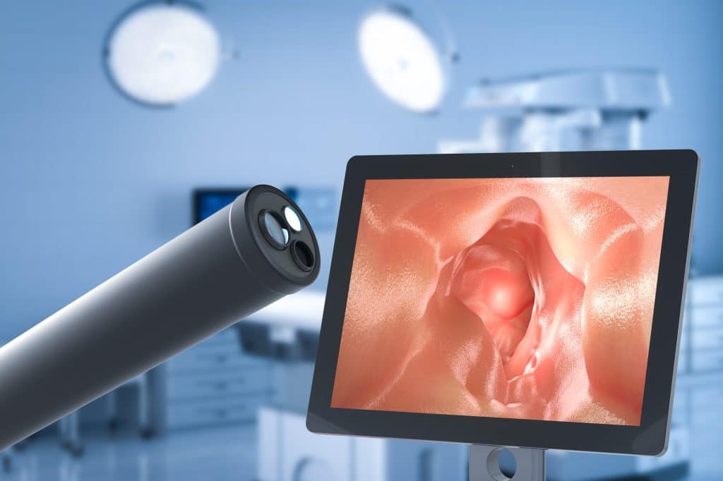 Endoscopy is a medical treatment that examines the body's internal organs, cavities, and supporting structures using a specialized instrument called an endoscope