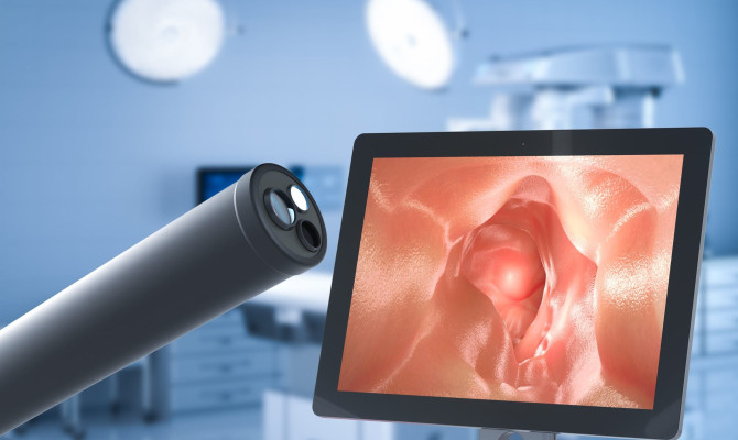 Understanding Endoscopy: Types, Uses, Benefits and Risks