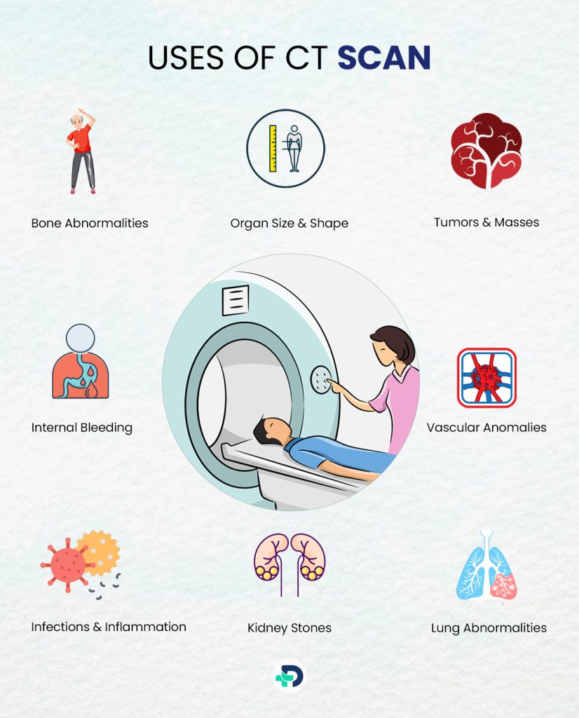 Uses of CT Scan.