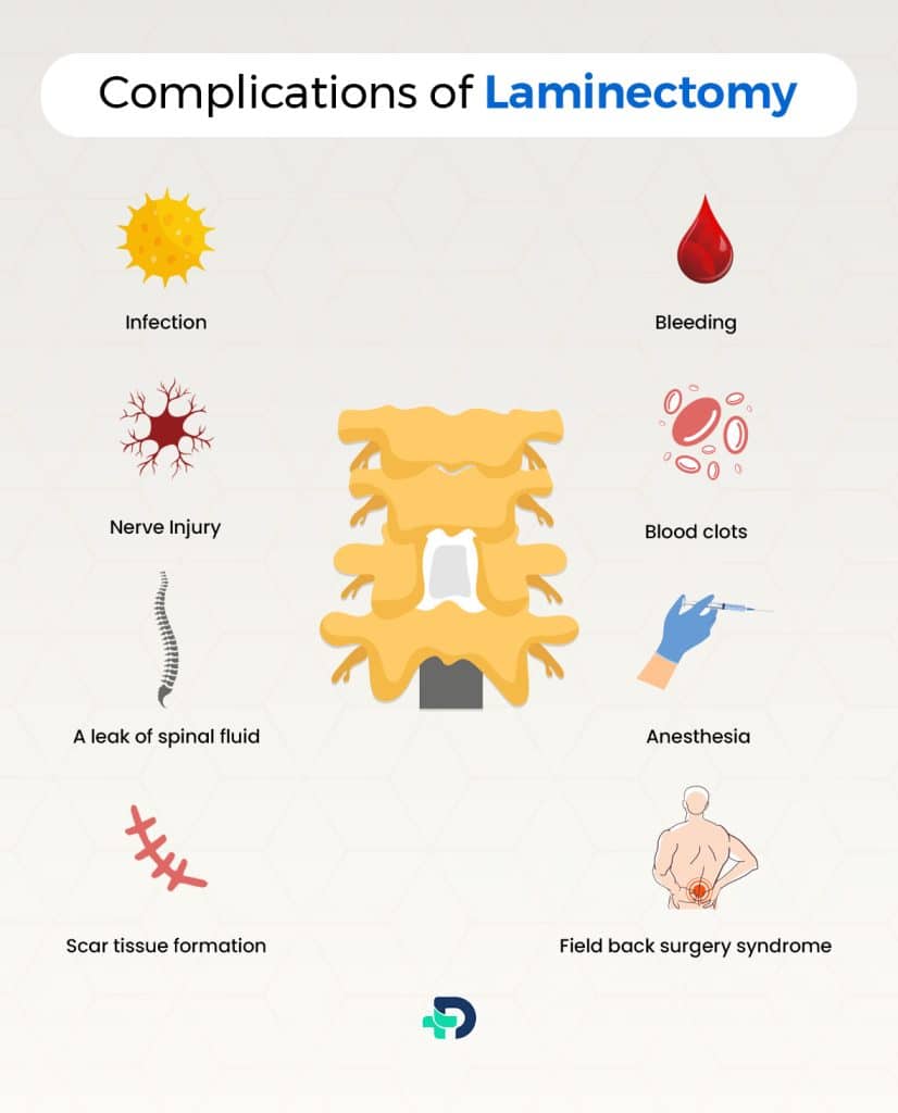 Complications of Laminectomy.