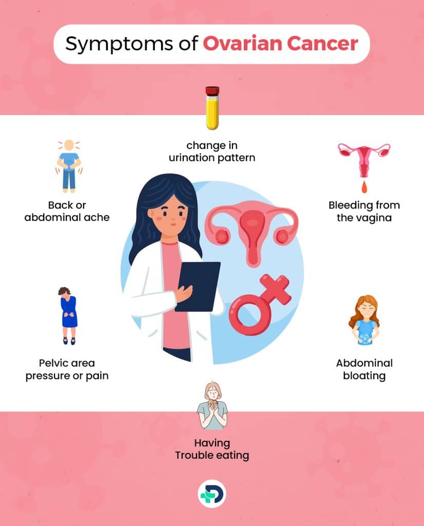 Symptoms of Ovarian Cancer.