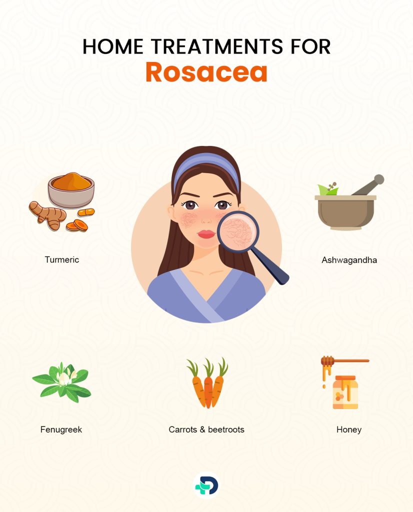 Home treatments for Rosacea.
