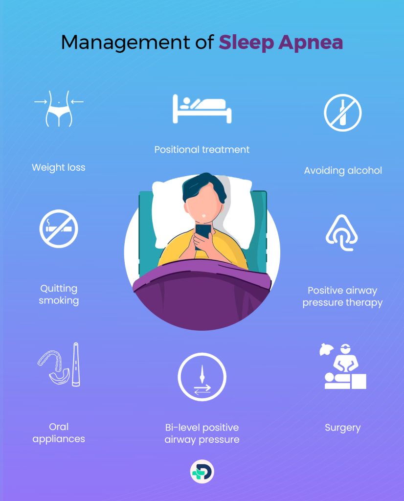 Management of Sleep Apnea.