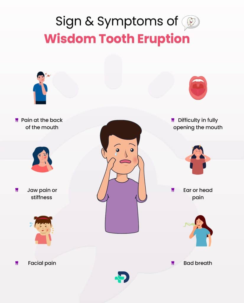 Sign & symptoms of Wisdom Tooth Eruption.