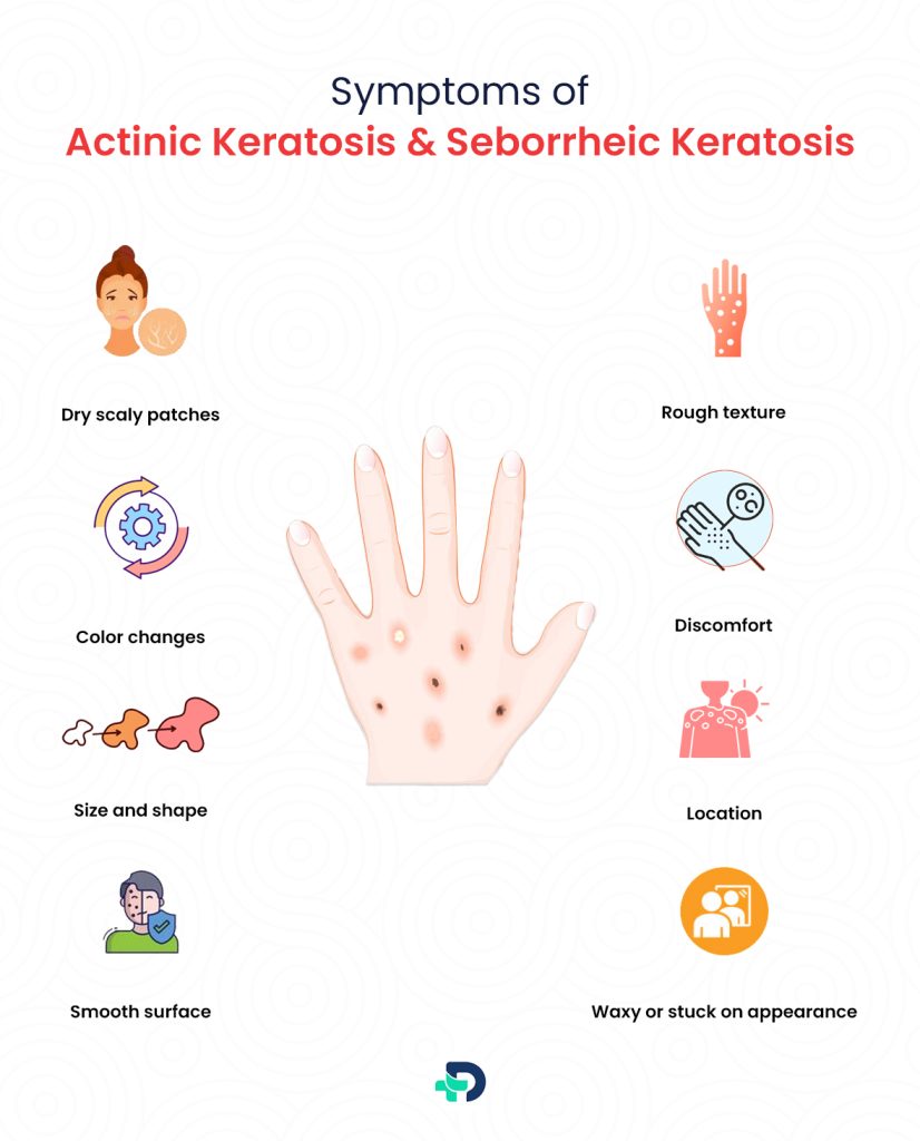 Symptoms of Actinic Keratosis & Seborrheic Keratosis.