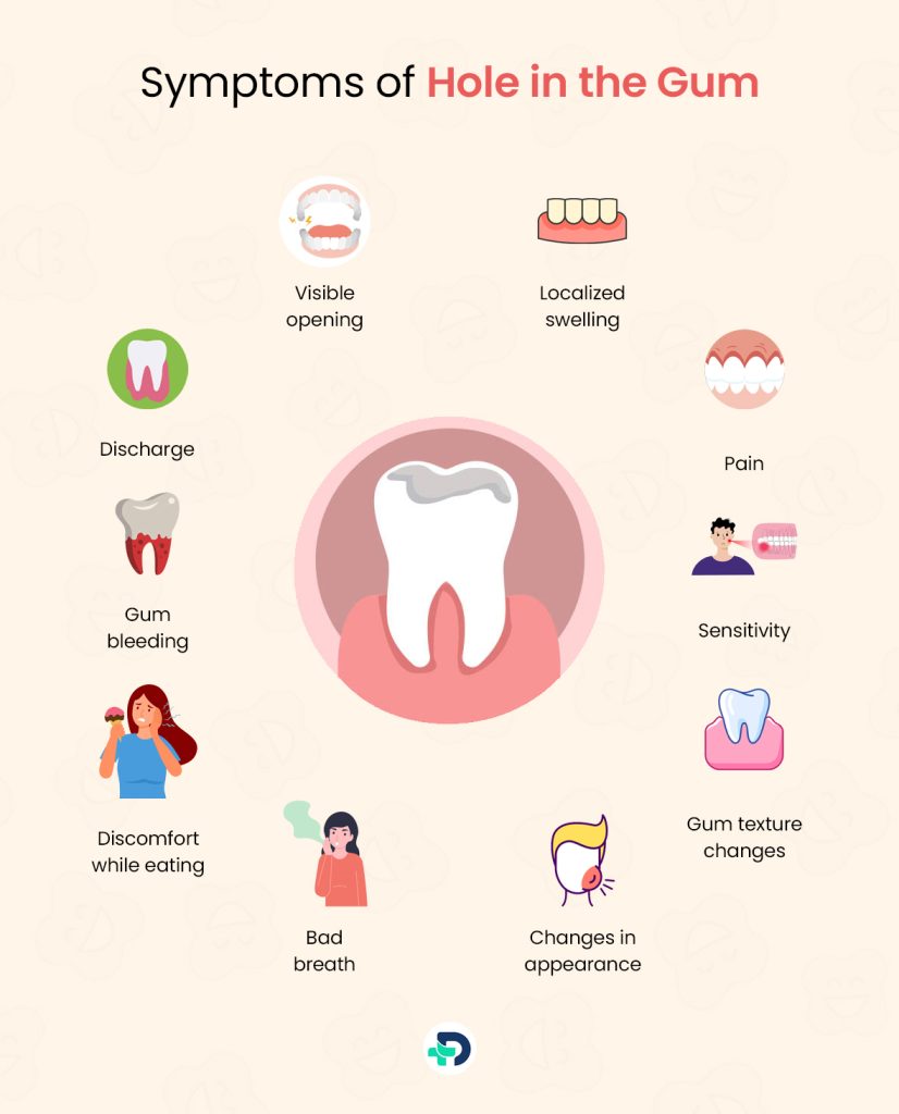 Symptoms of Hole in the Gum.