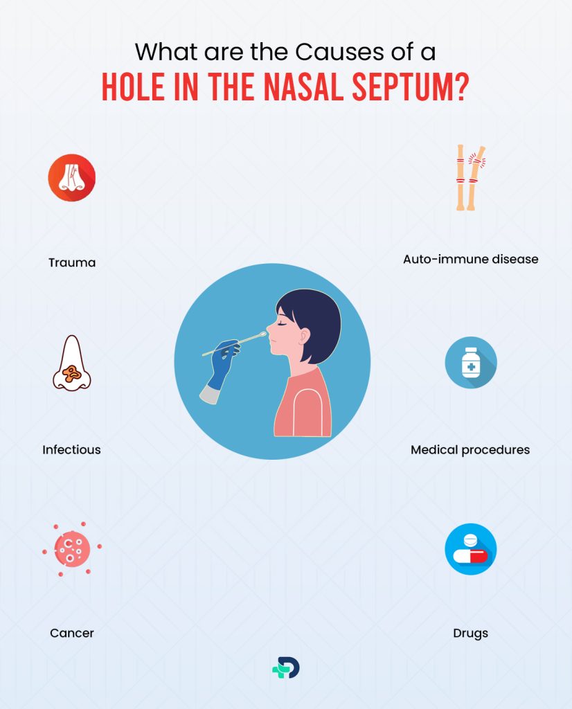 What are the causes of a Hole in the nasal Septum?