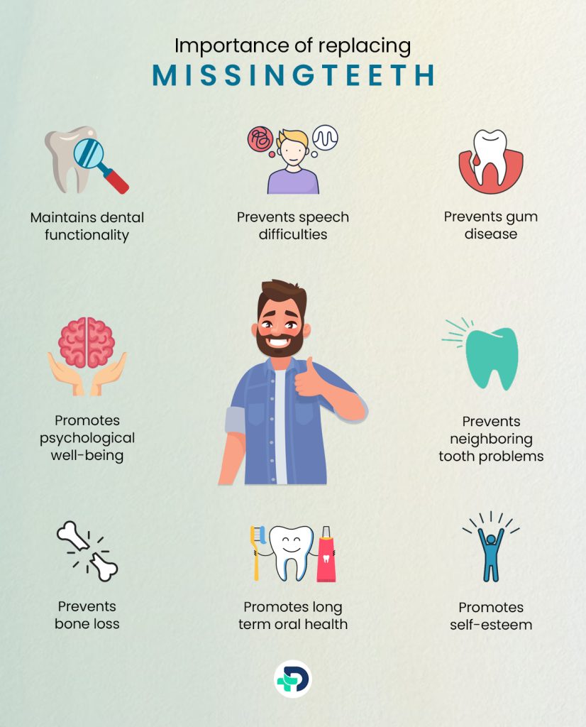 Importance of replacing missing teeth.