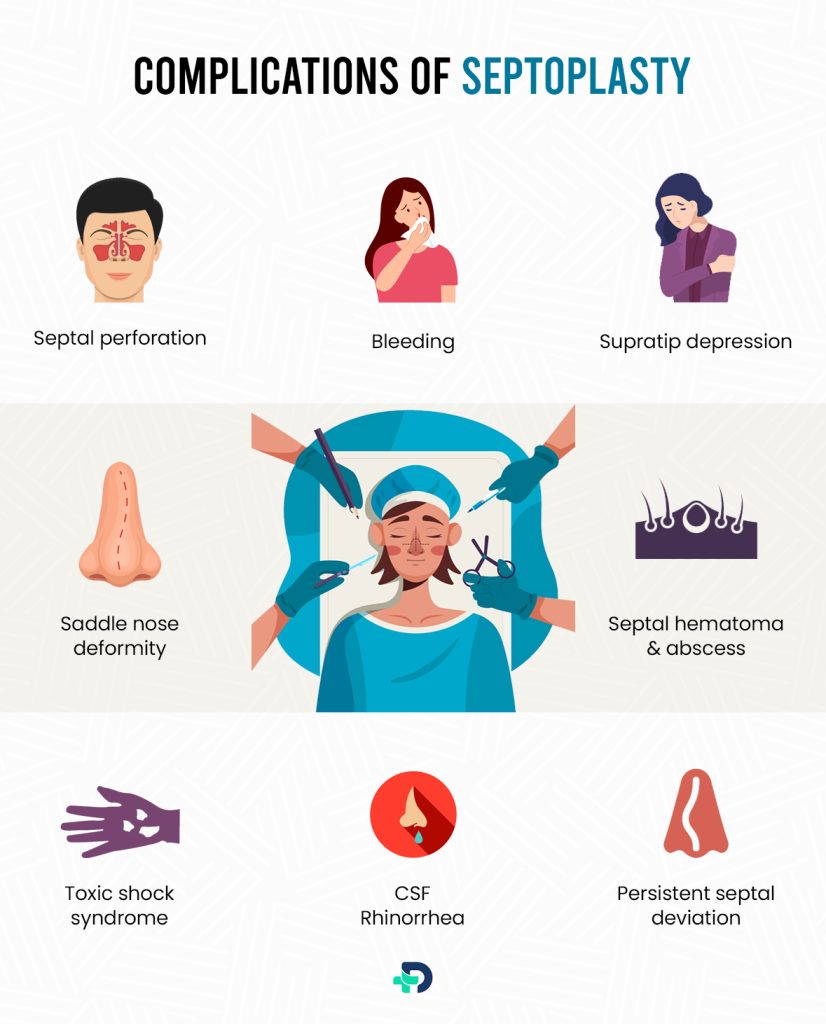 Complications of Septoplasty.