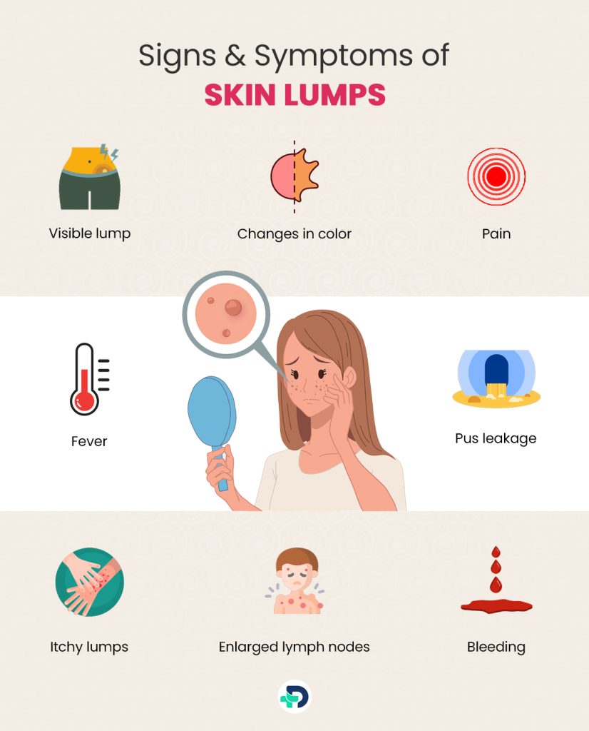 Signs & Symptoms of Skin Lumps.