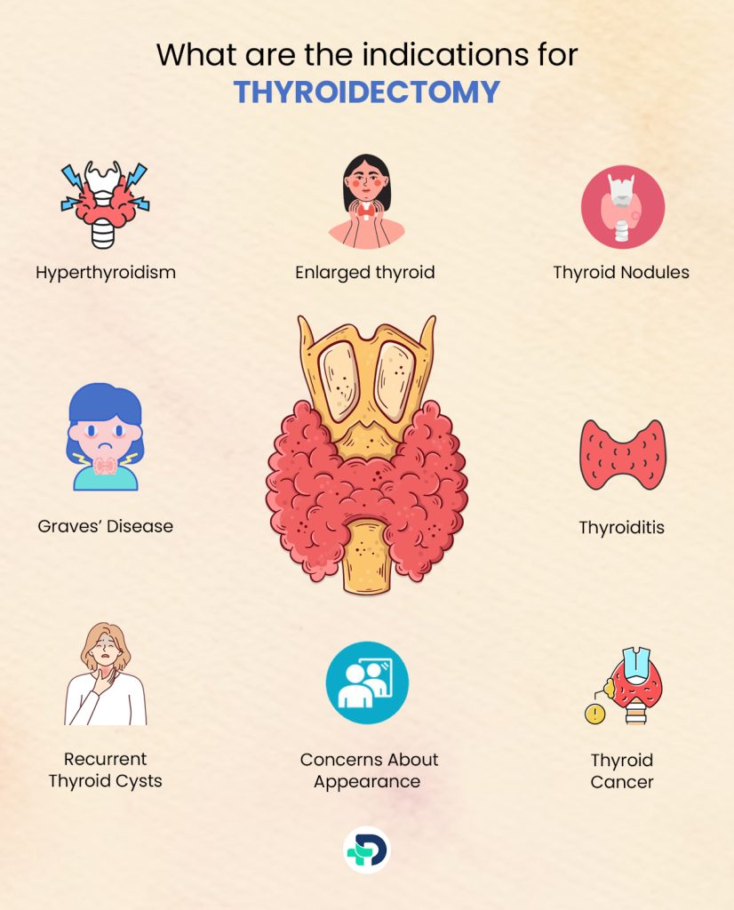 What are the indications for Thyroidectomy.