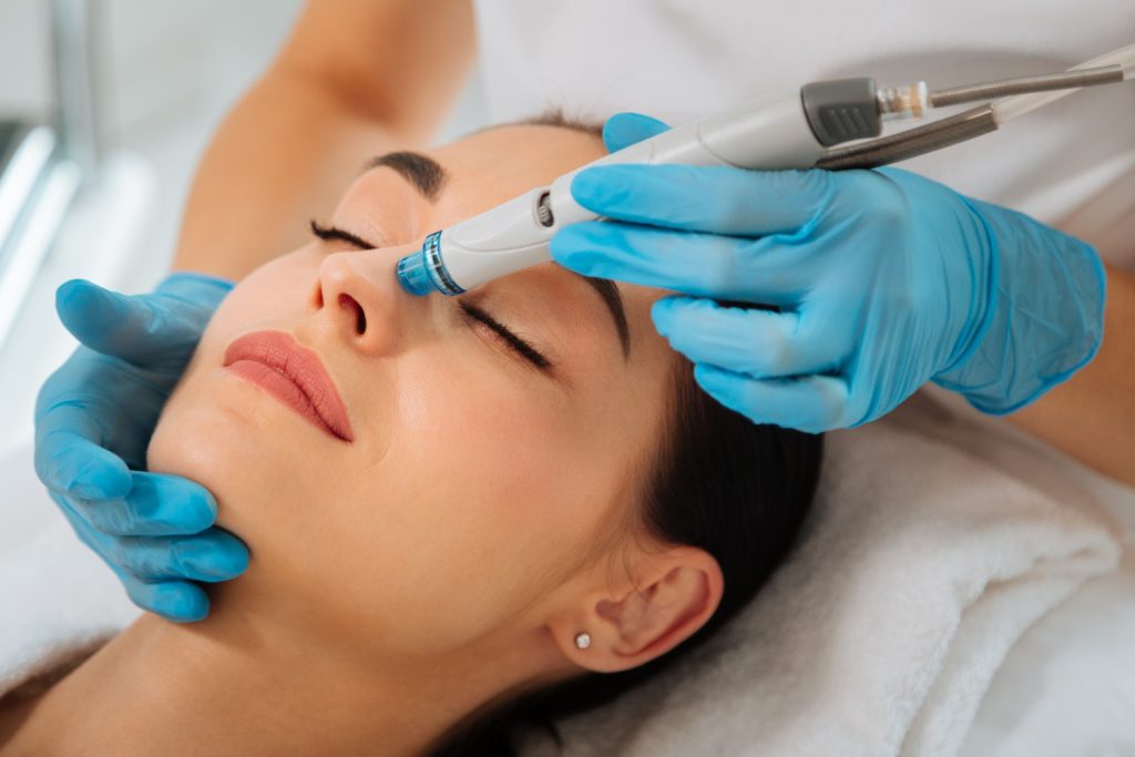 Microneedling is a nonsurgical technique done in a dermatologist's clinic that is minimally invasive.