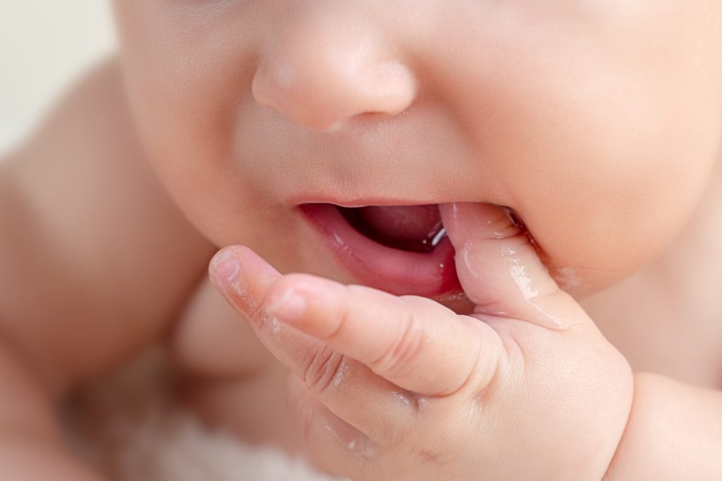 Babies, particularly newborns, can develop lip blisters referred to as milk blisters, sucking blisters, or lip calluses. These sucking blisters may result from routine activities like learning how to breastfeed or bottle-feed, or in rare instances, may indicate an infection.