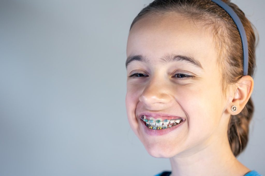 Braces are a great orthodontic treatment option that has helped millions get straight smiles and better dental health. A critical feature of the braces is that, despite appearing less obvious, it is vital to use rubber bands. 