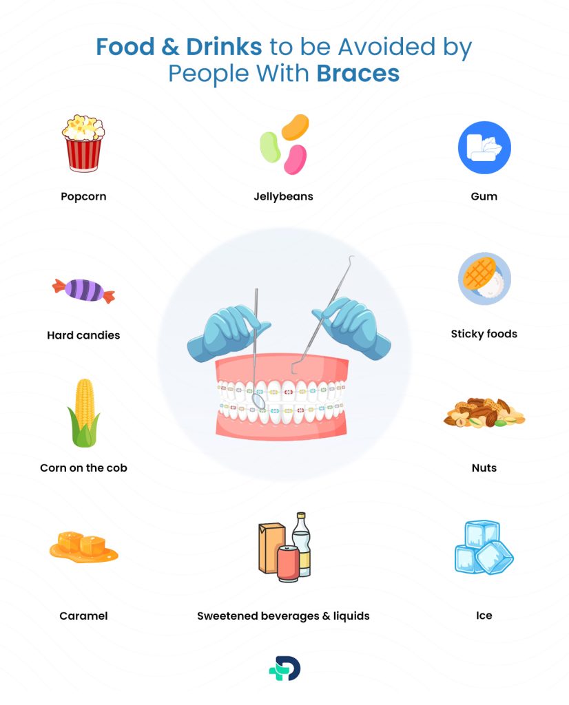 Food & Drinks to be Avoided by people with Braces.