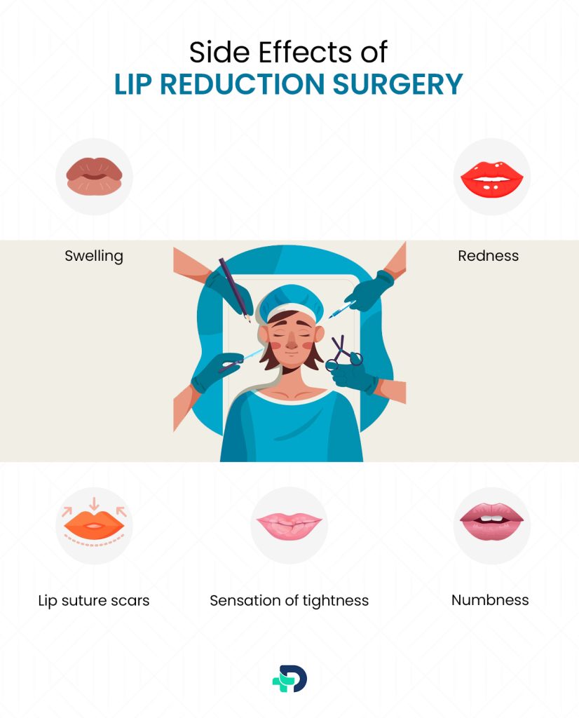 Side effects of Lip Reduction Surgery.