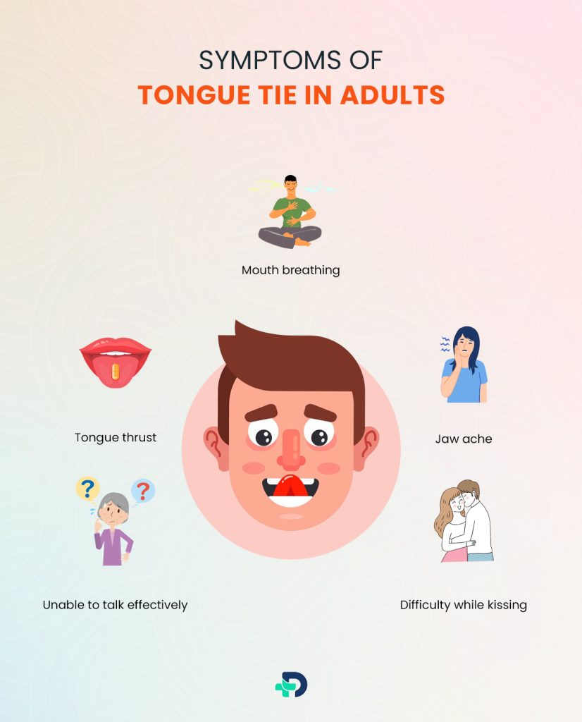 Symptoms of Tongue Tie in Adults.