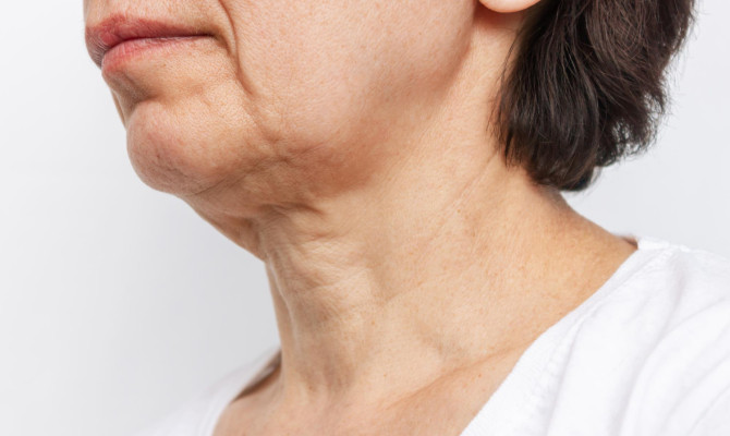 Everything You Need To Know About  Non-Surgical Neck Lift Methods