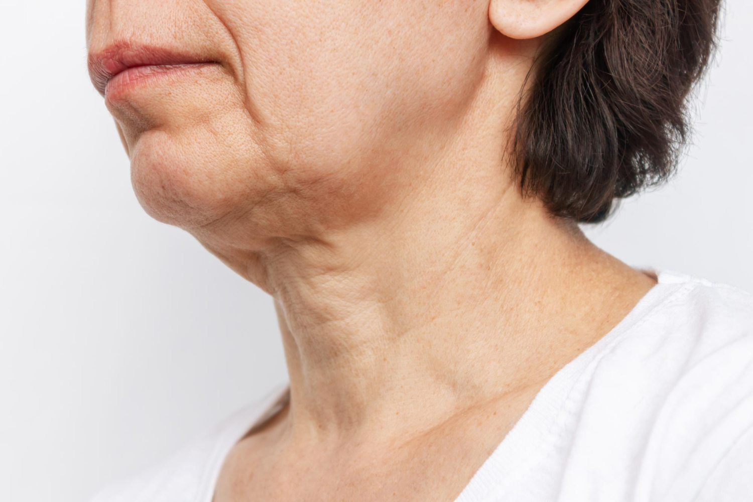 Everything You Need To Know About  Non-Surgical Neck Lift Methods