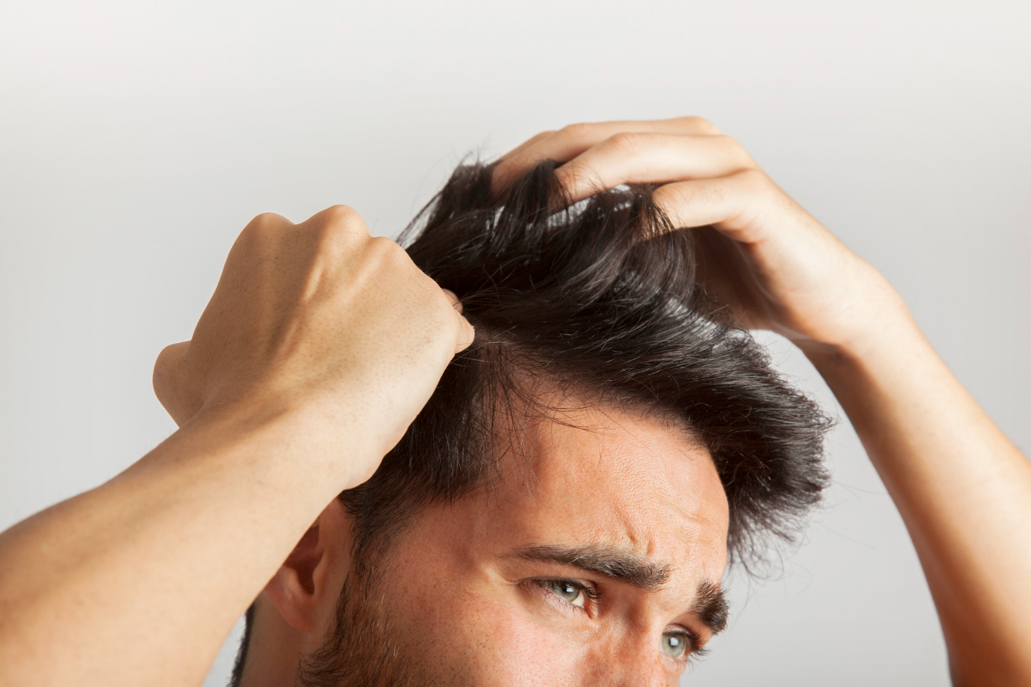 Metformin Side Effects: Is Hair Loss A Genuine Concern?