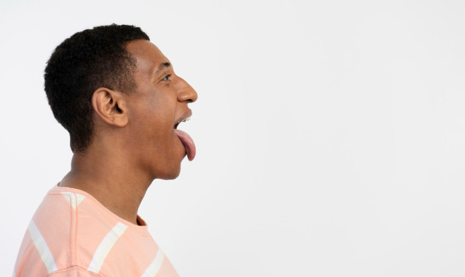 Diagnosis & Management Of Tongue Tie In Adults