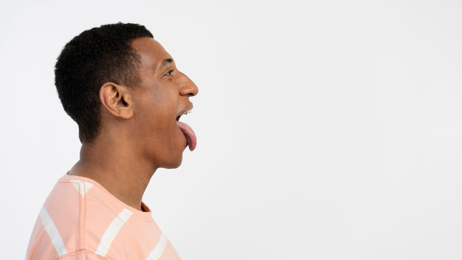 Diagnosis & Management Of Tongue Tie In Adults